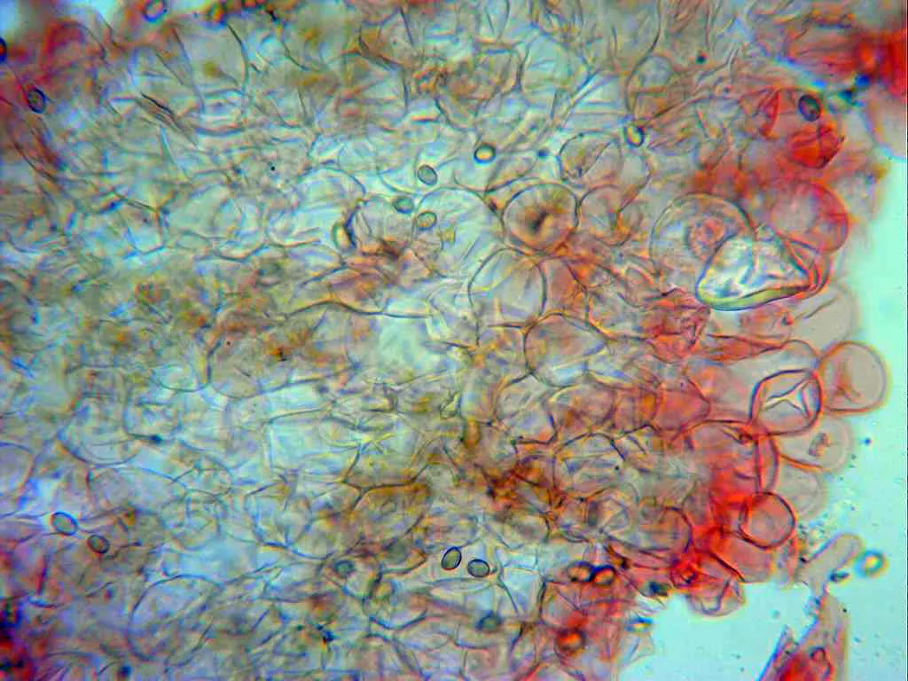 Microscopía de Psathyrella inflatocystis - 10 - Suprapellis frontal x 400 2
